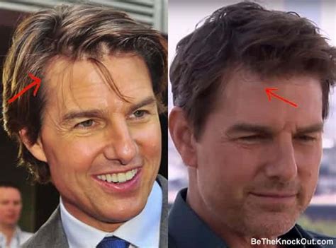 Tom cruise balding. Things To Know About Tom cruise balding. 